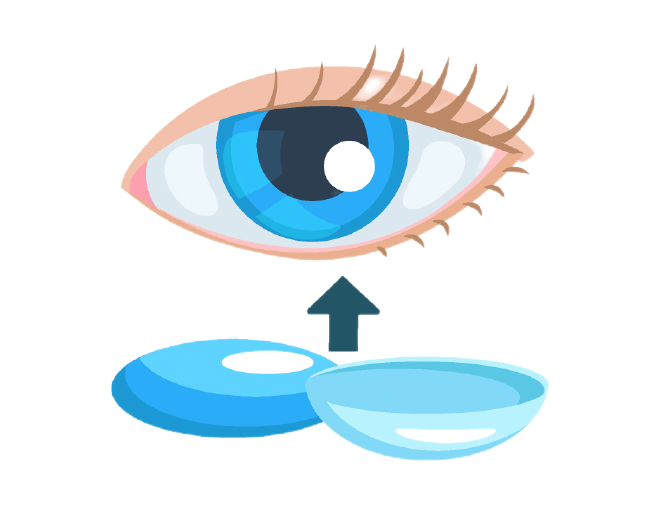 uso de lentillas orto-k